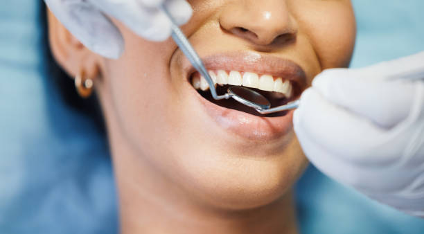 Best Emergency Dental Services for Seniors in Rock Falls, IL